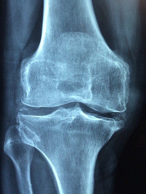 Mobility Duo Knee Xray