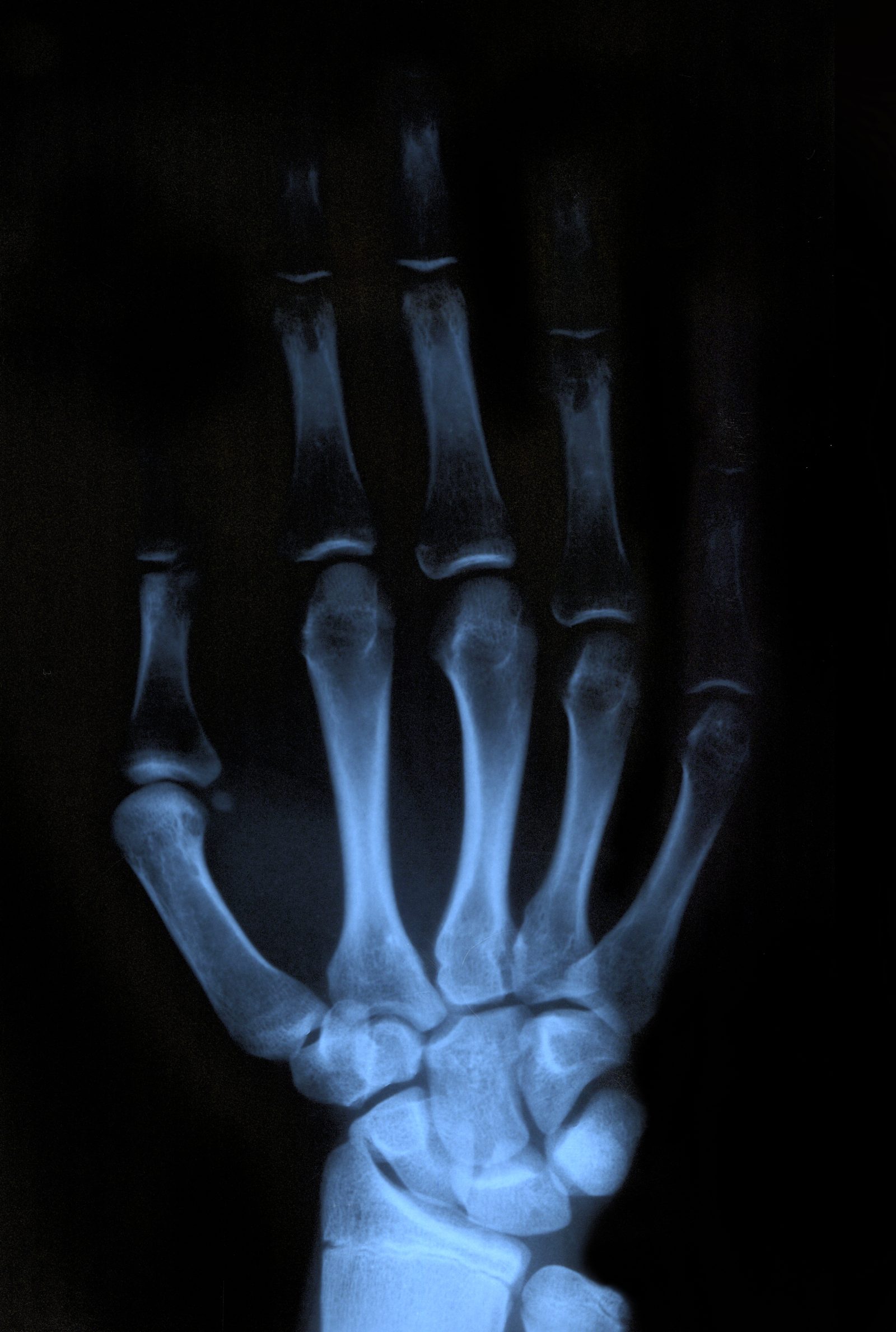 X ray of hand 934782